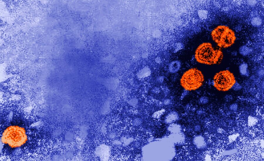 Trump admin awards hepatitis B vaccine contract to Europeans working in Guinea-Bissau